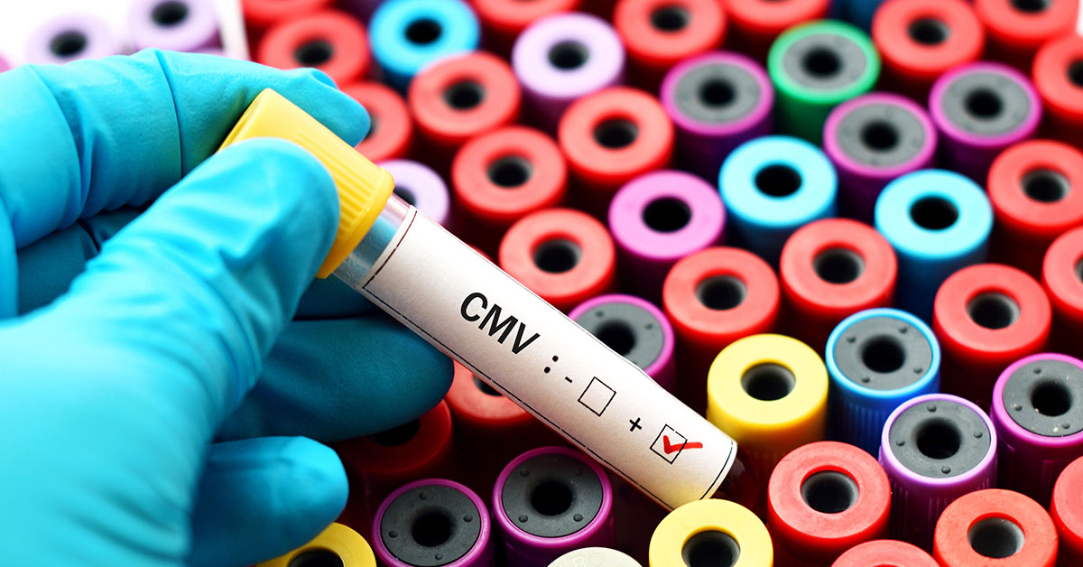 What Is Congenital CMV?